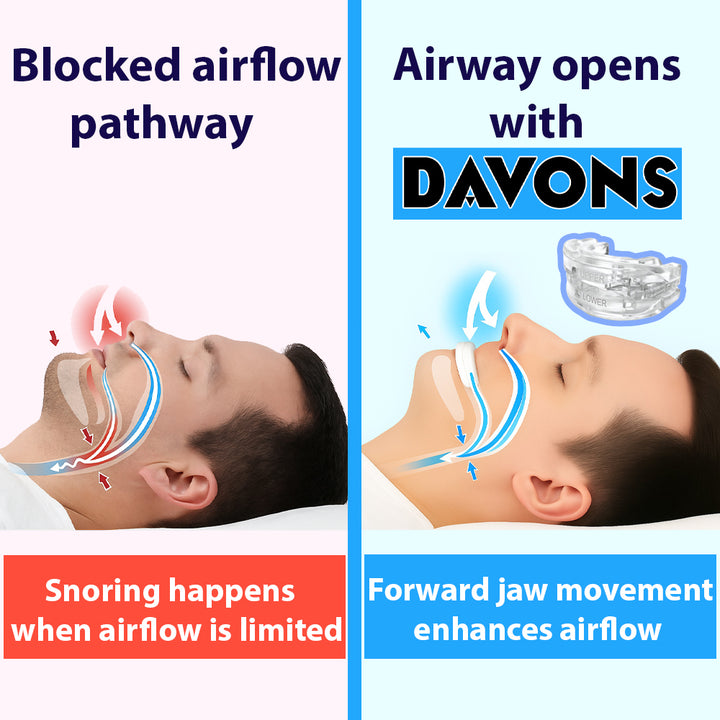 ANTI-SNORE PRO™